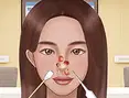 Nose Hospital